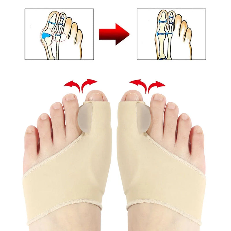 Separador Toe, hálux valgo, corrector joanete, órteses, osso, ajustador polegar, pedicure, alisador meia