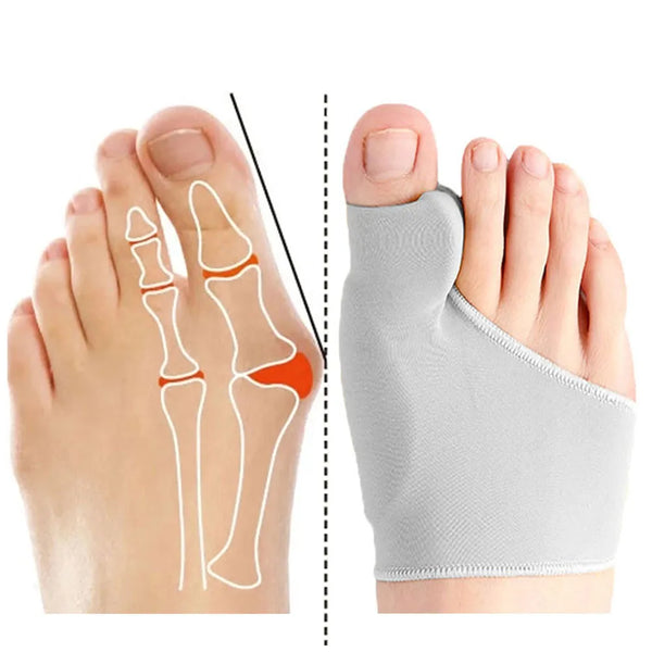 Separador Toe, hálux valgo, corrector joanete, órteses, osso, ajustador polegar, pedicure, alisador meia